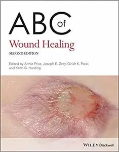 ABC of Wound Healing, 2nd Edition