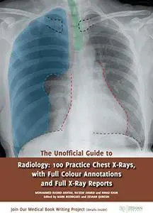 The Unofficial Guide to Radiology: 100 Practice Chest X Rays with Full Colour Annotations and Full X Ray Reports (Repost)