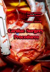 "Cardiac Surgery Procedures" ed. by Andrea Montalto, Antonio Loforte, Cristiano Amarelli