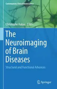 The Neuroimaging of Brain Diseases: Structural and Functional Advances