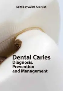 "Dental Caries: Diagnosis, Prevention and Management" ed. by Zühre Akarslan