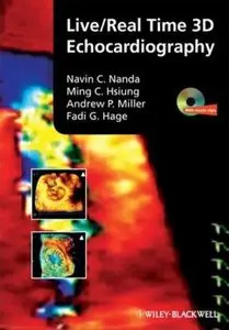 Live/real Time 3D Echocardiography [Repost]