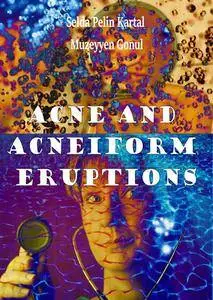 "Acne and Acneiform Eruptions" ed. by Selda Pelin Kartal and Muzeyyen Gonul