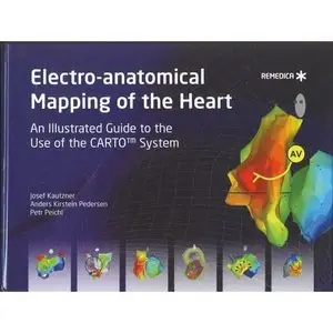 Electro-anatomical Mapping of the Heart  