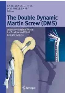 The Double Dynamic Martin Screw (DMS): Adjustable Implant System for Proximal and Distal Femur Fractures