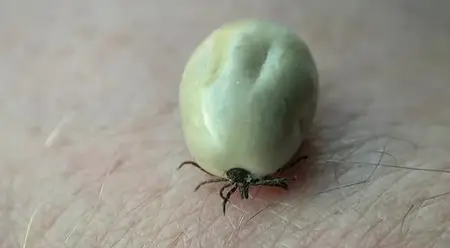 (Fr5) La maladie de Lyme, quand les tiques attaquent ! (2014)