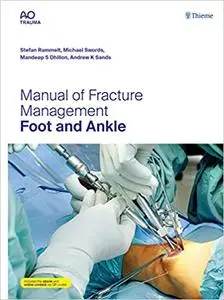 Manual of Fracture Management - Foot and Ankle Illustrated Edition