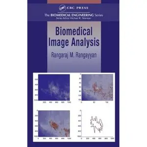 Biomedical Image Analysis (Biomedical Engineering) by Rangaraj M. Rangayyan