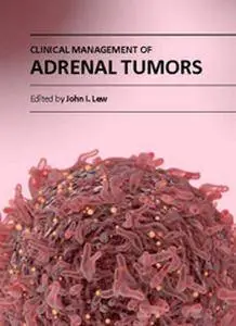 "Clinical Management of Adrenal Tumors" ed. by John I. Lew