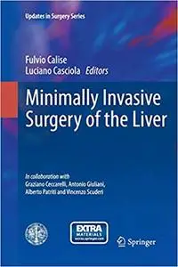 Minimally Invasive Surgery of the Liver