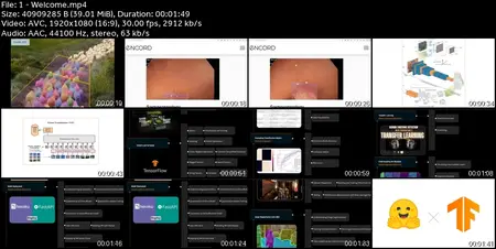 Master Deep Learning for Computer Vision in TensorFlow[2025]