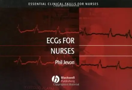 ECGs for Nurses (Essential Clinical Skills for Nurses) by Philip Jevon