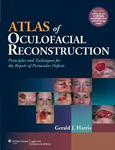 Atlas of Oculofacial Reconstruction: Principles and Techniques for the Repair of Periocular Defects