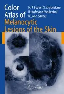 Color atlas of melanocytic lesions of the skin