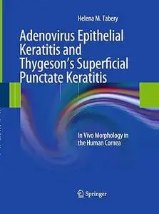Adenovirus Epithelial Keratitis and Thygeson's Superficial Punctate Keratitis: In Vivo Morphology in the Human Cornea (Repost)
