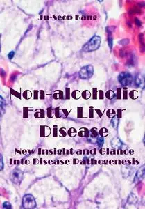 "Non-alcoholic Fatty Liver Disease: New Insight and Glance Into Disease Pathogenesis" Ju-Seop Kang