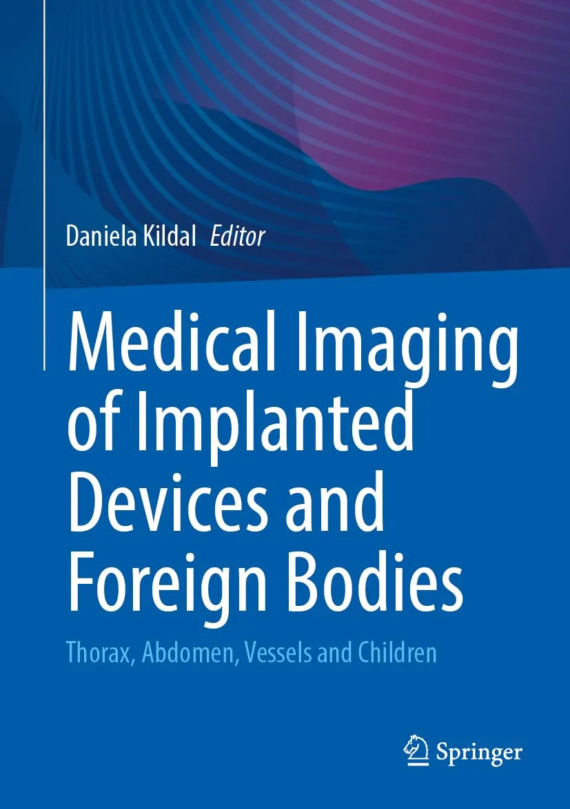 Medical Imaging of Implanted Devices and Foreign Bodies: Thorax, Abdomen, Vessels and Children