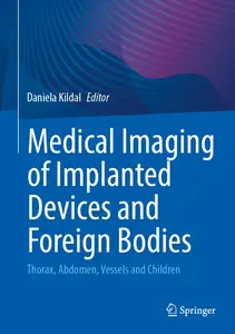 Medical Imaging of Implanted Devices and Foreign Bodies: Thorax, Abdomen, Vessels and Children
