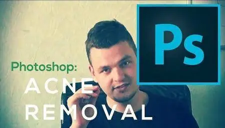 Photoshop: Easiest Way To Remove Acne
