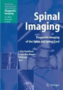Spinal Imaging: Diagnostic Imaging of the Spine and Spinal Cord