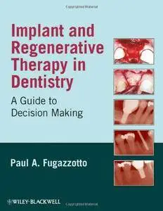 Implant and Regenerative Therapy in Dentistry: A Guide to Decision Making (repost)