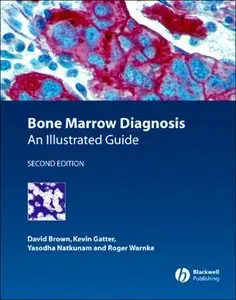 Bone Marrow Diagnosis: An Illustrated Guide, 2 edition