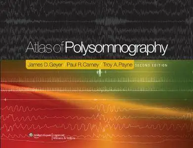 Atlas of Polysomnography, Second edition (repost)