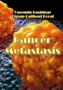 "Cancer Metastasis" ed. by Yasemin Basbinar, Gizem Calibasi Kocal