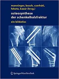 Osteosynthese der Schenkelhalsfraktur: Ein Bildatlas