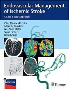 Endovascular Management of Ischemic Stroke: A Case-Based Approach by Vitor Mendes Pereira, Adam A. Dmytriw