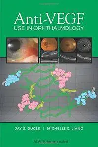 Anti-VEGF Use in Ophthalmology