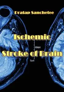 "Ischemic Stroke of Brain" ed. by Pratap Sanchetee