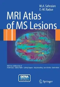 MRI Atlas of MS Lesions
