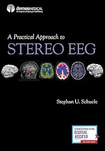 A Practical Approach to Stereo EEG