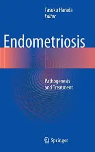 Endometriosis: Pathogenesis and Treatment (Repost)