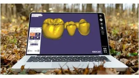 Digital flow in dentistry and basic exocad program