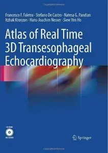 Atlas of Real Time 3D Transesophageal Echocardiography [Repost]