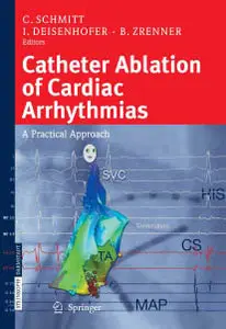 Catheter Ablation of Cardiac Arrhythmias [Repost]