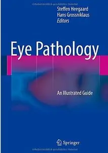 Eye Pathology: An Illustrated Guide [Repost]