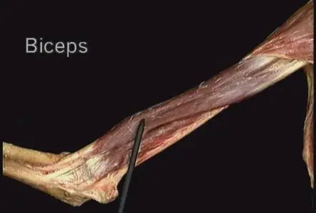 Atlas of Human Anatomy in 3D(Disc 1 of 6: The Upper Extremity)