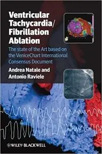 Ventricular Tachycardia / Fibrillation Ablation: The state of the Art based on the VeniceChart International Consensus Document