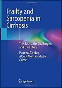 Frailty and Sarcopenia in Cirrhosis: The Basics, the Challenges, and the Future