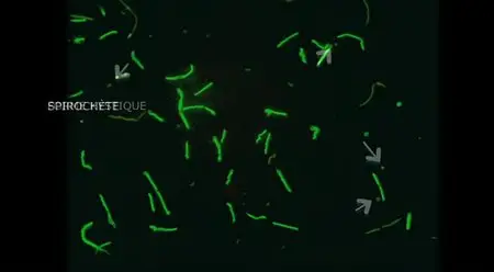 (Fr5) La maladie de Lyme, quand les tiques attaquent ! (2014)