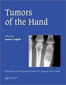 Tumors of the Hand: Published in association with the Federation of European Societies for Surgery of the Hand