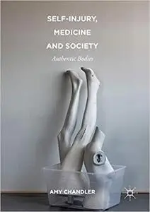 Self-Injury, Medicine and Society: Authentic Bodies (Repost)