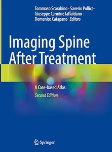 Imaging Spine After Treatment: A Case-based Atlas (Repost)