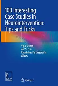 100 Interesting Case Studies in Neurointervention: Tips and Tricks (Repost)