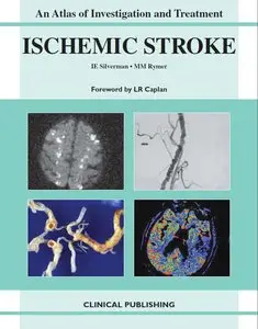 Ischemic Stroke: An Atlas of Investigation and Treatment