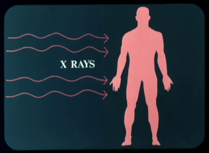 G Edward Griffin - World Without Cancer The Story of Vitamin B17 (1974)