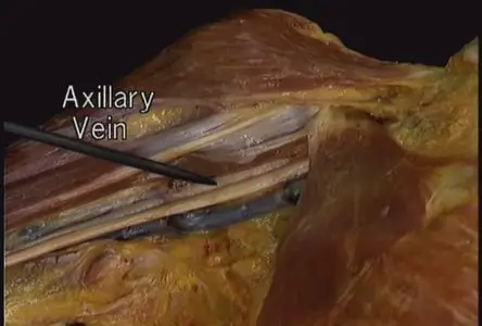 Atlas of Human Anatomy in 3D(Disc 1 of 6: The Upper Extremity)
